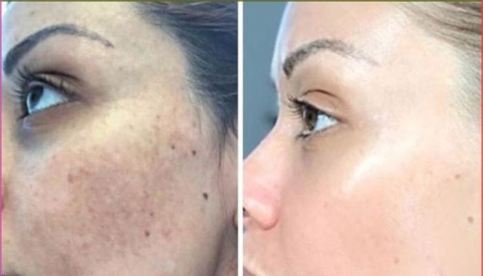 BB-Glow-CC-Glow-Treatment