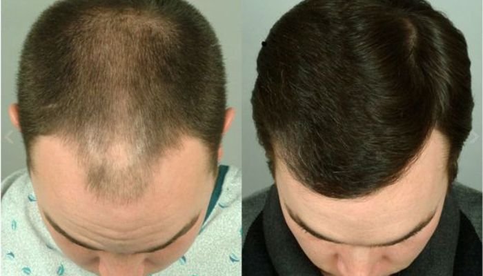 Hair-GFC-Growth-Factor-Concentrate