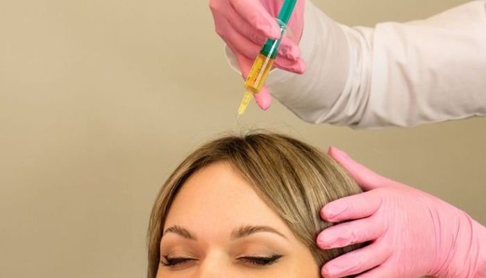 Hair-PRP-Platelet-Rich-Plasma