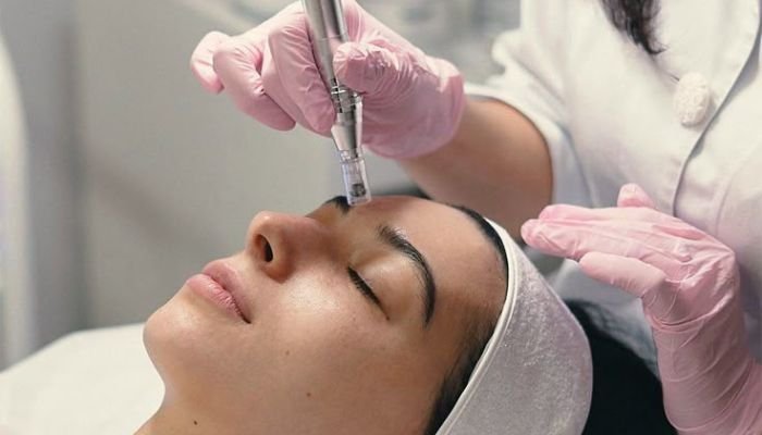 Microneedling