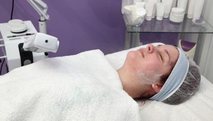 TCA-Peel-Trichloroacetic-Acid