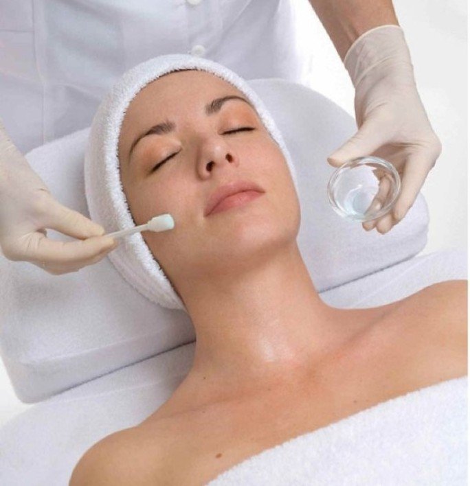 chemical-peel