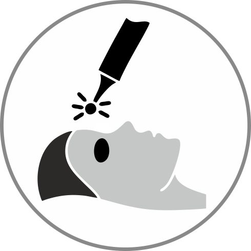 laser-treatment